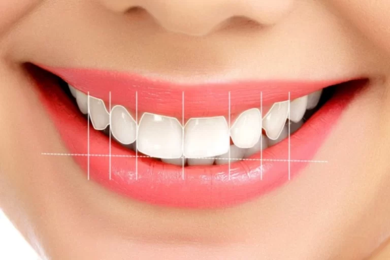 diş tasarımı nedir